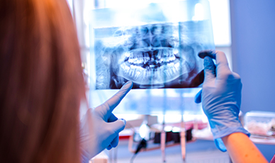 O plástico no consultório dentário